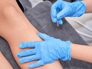 Dry needling applied near the knee. | Photo by Jimartinfotographo / iStock / NHA File Photo